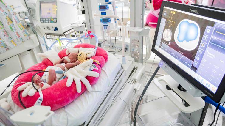 Zlínská neonatologie má nový monitor plicních funkcí novorozenců