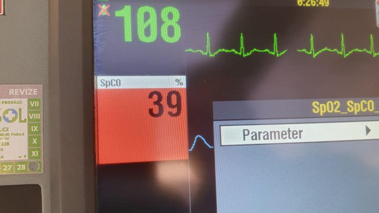 ​​​​​​​Foto: ZZS ZK