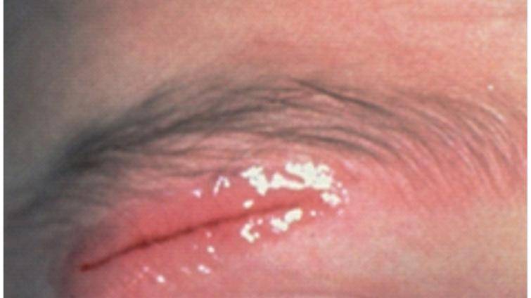 Foto: Uherskohradišťská nemocnice