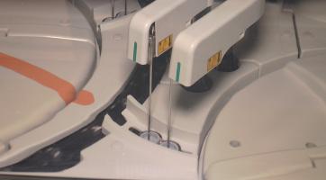 KNTB detekuje genetické onemocnění z pupečníkové krve