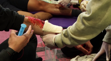 Mladí zdravotníci si poradili s bezvědomím i popáleninami