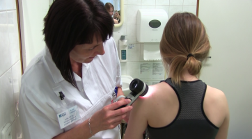 Melanomový den odhalil sedmnáct pozitivních nálezů