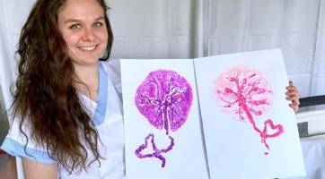 Porodnice ve Valašském Meziříčí nabízí rodičkám unikátní otisk placenty