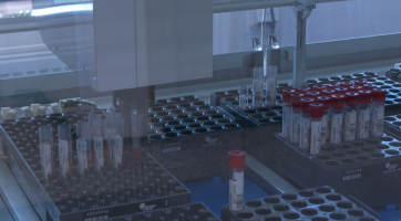 Oddělení klinické biochemie Uherskohradišťské nemocnice