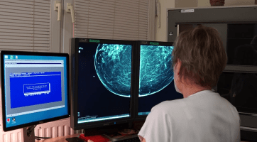 Prevence rakoviny prsu v Uherskohradišťské nemocnici