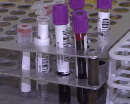 Nemocnice děkuje všem dárcům krve