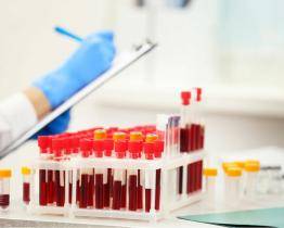 Ve Zlíně z pupečníkové krve novorozenců odhalí genetické onemocnění