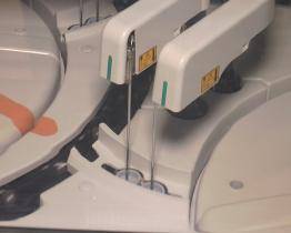 KNTB detekuje genetické onemocnění z pupečníkové krve