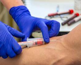 Baťova nemocnice hledá mladé pravidelné dárce krve