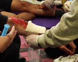 Mladí zdravotníci si poradili s bezvědomím i popáleninami