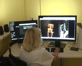 Vsetínská nemocnice má nové diagnostické přístroje