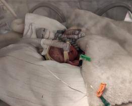 Matoušek se narodil ve 29. týdnu těhotenství s rozštěpem rtu a patra. Díky specialistům KNTB má jeho příběh šťastný konec 