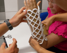 Uherskohradišťská nemocnice nabízí "sádru" do vody