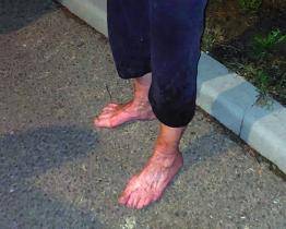 Dezorientovaná seniorka bloudila bosa nočním sídlištěm