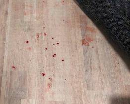 Facky, nůž i hozená miska. Za násilné incidenty ve Zlíně mohl alkohol a nezvládnuté emoce