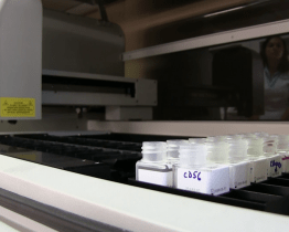 Nový přístroj na kyjovské patologii ulehčí vyšetření vzorků