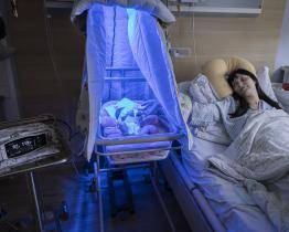 Léčba novorozenecké žloutenky probíhá ve zlínské porodnici přímo na pokoji