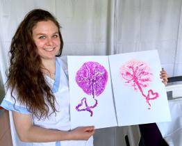 Porodnice ve Valašském Meziříčí nabízí rodičkám unikátní otisk placenty