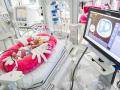 Zlínská neonatologie má nový monitor plicních funkcí novorozenců